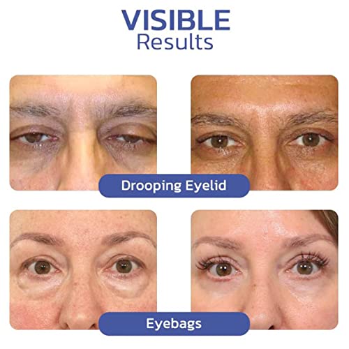 MAXTANG Lifting Eyelid Defining Cream, Невидим Бесследный Двоен крем за даване на форма средновековието, намалява Видимостта Спуска клепачите и бръчките В областта на очите (3 броя)
